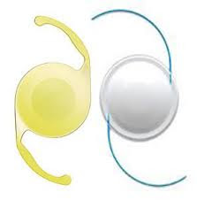 lentes-intraoculares-presbicia